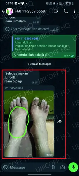 testimoni 5 hilangkan sakit gout uricoff